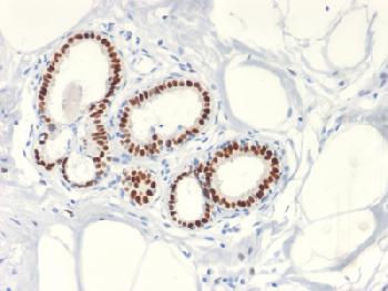 Anti-Estrogen Receptor, alpha (Marker of Estrogen Dependence) Recombinant Rabbit Monoclonal Antibody (Clone:ESR1/2299R)