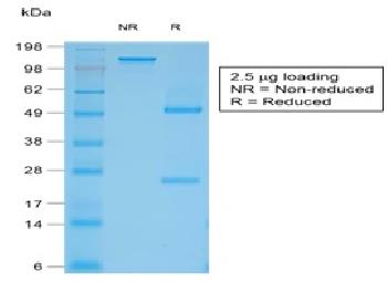 Anti-Filaggrin (Keratinocyte Differentiation Marker) Recombinant Mouse Monoclonal Antibody (Clone:rFLG/1561)