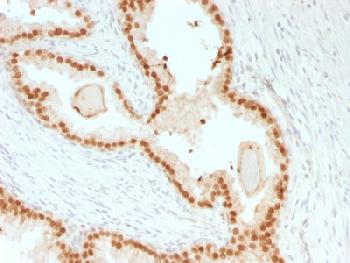 Anti-FOXA1 / HNF3A Recombinant Mouse Monoclonal Antibody (Clone:rFOXA1/1515)