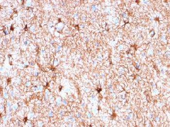 Anti-GFAP (Astrocyte & Neural Stem Cell Marker) Recombinant Mouse Monoclonal Antibody (Clone:rASTRO/789)