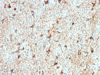 Anti-GFAP (Astrocyte & Neural Stem Cell Marker) Recombinant Rabbit Monoclonal Antibody (Clone:ASTRO/1974R)