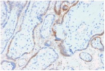 Anti-HCG-beta (Pregnancy & Choriocarcinoma Marker) Recombinant Mouse Monoclonal Antibody (Clone:rHCGb/54)