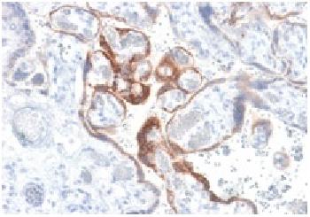 Anti-HCG-beta (Pregnancy & Choriocarcinoma Marker) Recombinant Rabbit Monoclonal Antibody (Clone:HCGb/1985R)