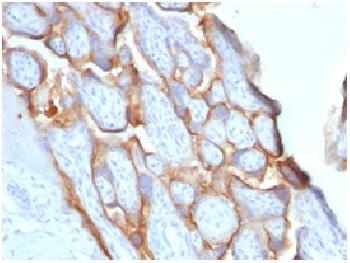 Anti-HCG-beta (Pregnancy & Choriocarcinoma Marker) Recombinant Rabbit Monoclonal Antibody (Clone:HCGb/1996R)