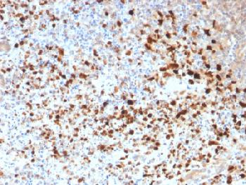 Anti-HSV1 (Herpes Simplex Virus Type I) Recombinant Mouse Monoclonal Antibody (Clone:HSVI/1934)