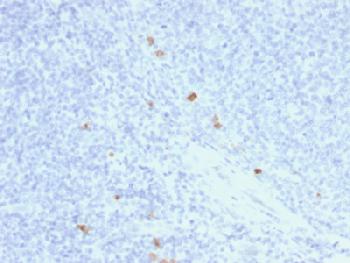 Anti-IgG4 (Ig Heavy Constant Gamma 4) (G4m Marker) Recombinant Mouse Monoclonal Antibody (Clone:rIGHG4/1345)