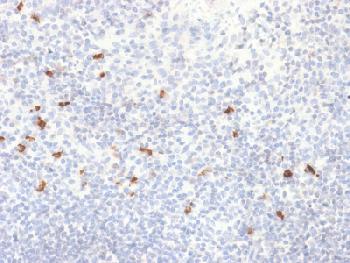 Anti-IgG4 (Ig Heavy Constant Gamma 4) (G4m Marker) Recombinant Rabbit Monoclonal Antibody (Clone:IGHG4/2042R)