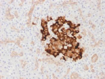 Anti-Insulin / IRDN (beta-Cell & Insulinoma Marker) Recombinant Rabbit Monoclonal Antibody (Clone:IRDN/1980R)