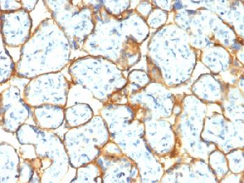 Anti-Insulin Receptor Alpha Recombinant Rabbit Monoclonal Antibody (Clone:INSR/2277R)