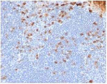 Anti-Kappa Light Chain (B-Cell Marker) Recombinant Mouse Monoclonal Antibody (Clone:rL1C1)