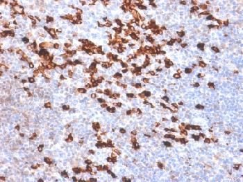 Anti-Kappa Light Chain (B-Cell Marker) Recombinant Rabbit Monoclonal Antibody (Clone:IGKC/1999R)