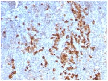 Anti-Kappa Light Chain / IGKC (B-Cell Marker) Recombinant Mouse Monoclonal Antibody (Clone:rKLC709)