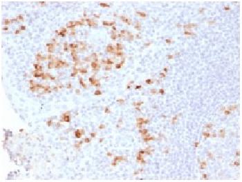 Anti-Kappa Light Chain / IGKC (B-Cell Marker) Recombinant Rabbit Monoclonal Antibody (Clone:KLC2289R)