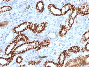 Anti-Ksp-Cadherin (Kidney-Specific Cadherin) / CDH16 Recombinant  Mouse Monoclonal Antibody (Clone:rCDH16/1071)