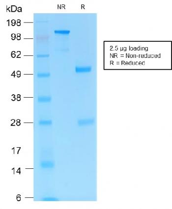 Anti-MART-1 / Melan-A / MLANA (Melanoma Marker) Recombinant Mouse Monoclonal Antibody (Clone:rMLANA/1905)