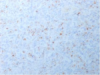 Anti-MMP3 Recombinant Rabbit Monoclonal Antibody (Clone:MMP3/1994R)