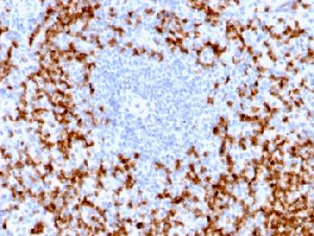 Anti-MMP9 Recombinant Rabbit Monoclonal Antibody (Clone:MMP9/2025R)