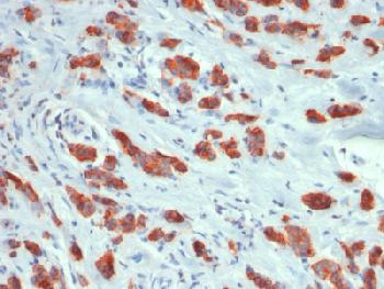 Anti-MUC1 / CA15-3 / EMA / CD227 (Epithelial Marker) Recombinant Rabbit Monoclonal Antibody (Clone:MUC1/1887R)