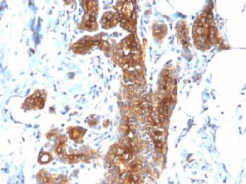 Anti-MUC1 / CA15-3 / EMA / CD227 (Epithelial Marker) Recombinant Rabbit Monoclonal Antibody (Clone:MUC1/2278R)