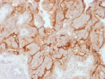 Anti-MUC16 / CA125 (Ovarian Carcinoma Marker) Recombinant Rabbit Monoclonal Antibody (Clone:OCA125/2349R)