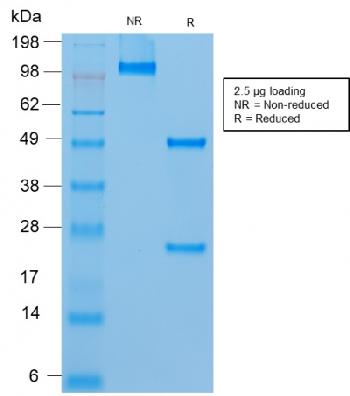 Anti-MUC18 / CD146 / MCAM (Melanoma Cell Adhesion Molecule) Recombinant Mouse Monoclonal Antibody (Clone:rMUC18/1130)