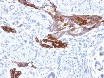 Anti-MUC6 (Mucin 6 / Gastric Mucin) Recombinant Rabbit Monoclonal Antibody (Clone:MUC6/1553R)