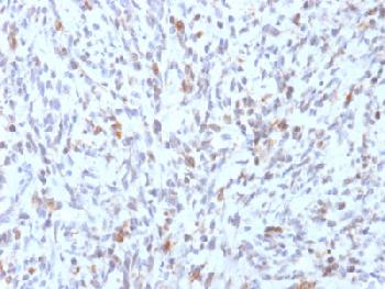 Anti-MyoD1 (Rhabdomyosarcoma Marker) Recombinant Mouse Monoclonal Antibody (Clone:rMYD712)