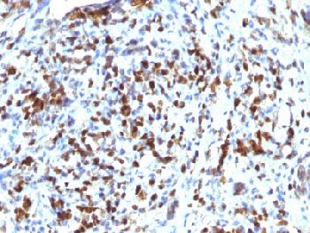 Anti-MyoD1 (Rhabdomyosarcoma Marker) Recombinant Rabbit Monoclonal Antibody (Clone:MYOD1/2075R)