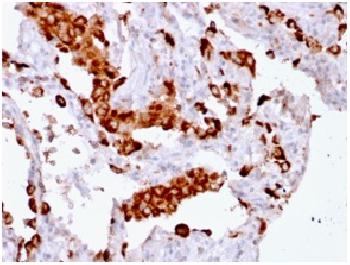 Anti-Napsin A (Lung Adenocarcinoma Marker) Recombinant Mouse Monoclonal Antibody (Clone:rNAPSA/1239)