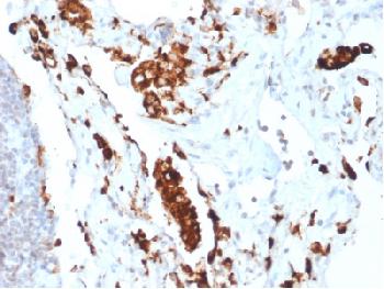 Anti-Napsin A (Lung Adenocarcinoma Marker) Recombinant Rabbit Monoclonal Antibody (Clone:NAPSA/1865R)