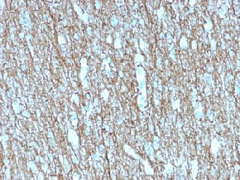 Anti-Neurofilament (NF-H) (Neuronal Marker) Recombinant Mouse Monoclonal Antibody (Clone:rNF421)