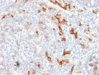 Anti-NGF-Receptor (p75) / CD271 (Soft Tissue Tumor Marker) Recombinant Rabbit Monoclonal Antibody (Clone:NGFR/1997R)