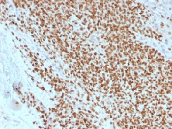 Anti-NKX2.2 (Neuroendocrine & Ewing s Sarcoma Marker) Recombinant Mouse Monoclonal Antibody (Clone:rNX2/1523)