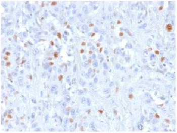 Anti-p21WAF1 (Tumor Suppressor Protein) Recombinant  Mouse Monoclonal Antibody (Clone:rCIP1/823)