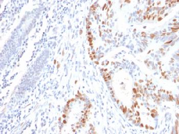 Anti-p53 Tumor Suppressor Protein Recombinant Mouse Monoclonal Antibody (Clone:rBP53-12)