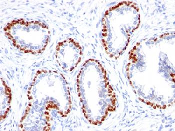 Anti-p63 (Squamous, Basal & Myoepithelial Cell Marker) Recombinant Rabbit Monoclonal Antibody (Clone:TP63/1423R)