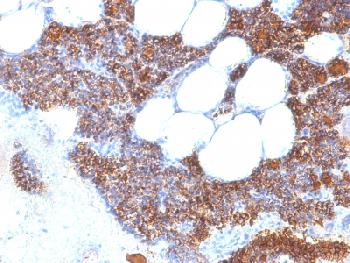 Anti-Parathyroid Hormone (PTH) (N-Terminal) Recombinant Rabbit Monoclonal Antibody (Clone:PTH/2295R)