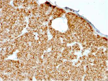 Anti-Parathyroid Hormone (PTH)(N-Terminal) Recombinant Mouse Monoclonal Antibody (Clone:rPTH/911)