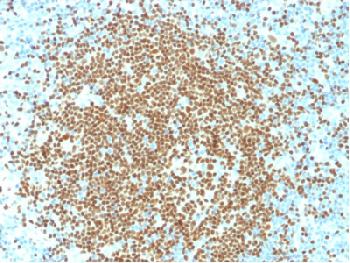 Anti-PAX5 / BSAP (Early B-Cell Marker) Recombinant Mouse Monoclonal Antibody (Clone:rPAX5/2060)