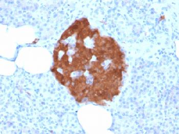 Anti-PGP9.5 / UchL1 (pan-Neuronal Marker) Recombinant Mouse Monoclonal Antibody (Clone:rUCHL1/775)