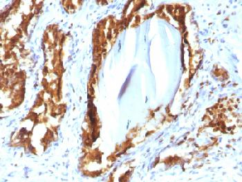 Anti-Prostate Specific Acid Phosphatase (PSAP) Recombinant Mouse Monoclonal Antibody (Clone:rACPP/1338)