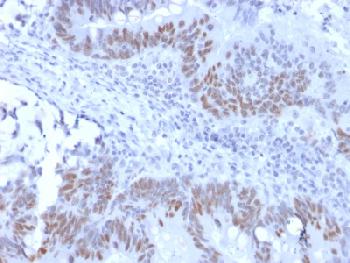 Anti-Rb1 (Tumor Suppressor Protein) Recombinant Rabbit Monoclonal Antibody (Clone:RB1/2313R)