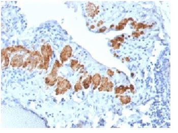 Anti-Smooth Muscle Myosin Heavy Chain (SM-MHC) Recombinant Rabbit Monoclonal Antibody (Clone:MYH11/2303R)