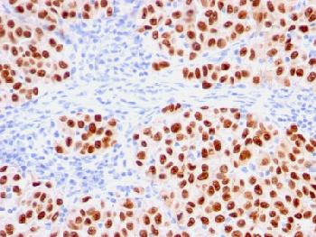 Anti-SOX10 (Melanoma Marker) Recombinant Mouse Monoclonal Antibody (Clone:rSOX10/1074)