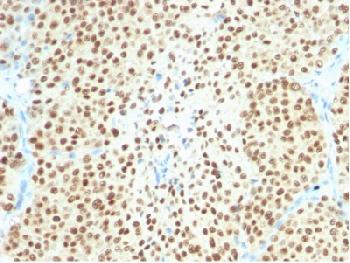 Anti-SOX10(Melanoma Marker) Recombinant Rabbit Monoclonal Antibody (Clone:SOX10/2311R)