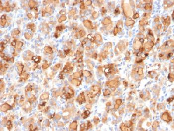 Anti-Thyroglobulin (Thyroidal Cell Marker) Recombinant Mouse Monoclonal Antibody (Clone:r2H11)