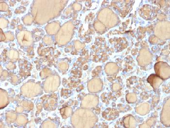 Anti-Thyroglobulin (Thyroidal Cell Marker) Recombinant Mouse Monoclonal Antibody (Clone:r6E1)