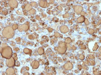 Anti-Thyroglobulin (Thyroidal Cell Marker) Recombinant Rabbit Monoclonal Antibody (Clone:TGB/1968R)