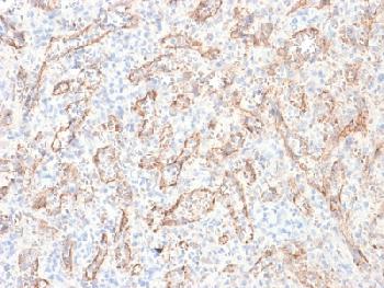 Anti-TNFS15 / VEGI (Vascular Endothelial Growth Inhibitor) Recombinant Mouse Monoclonal Antibody (Clone:rVEGI/1283)