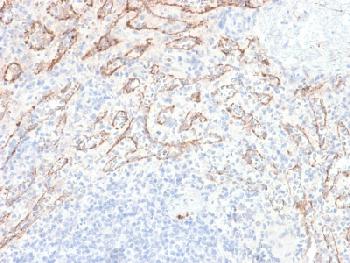 Anti-TNFS15 / VEGI (Vascular Endothelial Growth Inhibitor) Recombinant Rabbit Monoclonal Antibody (Clone:VEGI/2052R)